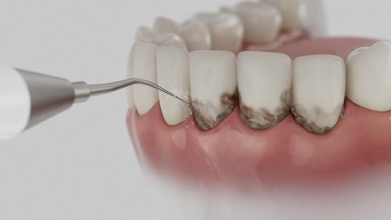 Trusted Dental Implants service in Carpendale, WV - Dentist Open Now